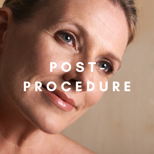 Post Procedure