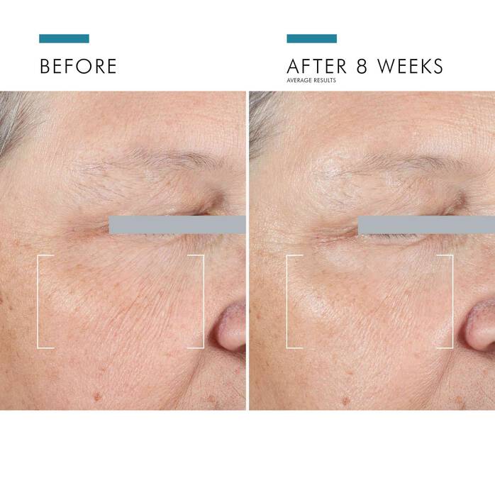 A.G.E. Eye Complex - SkinCeuticals Anti-Aging Eye Cream
