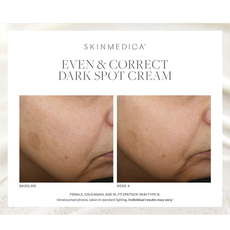 SkinMedica Even & Correct Dark Spot Cream