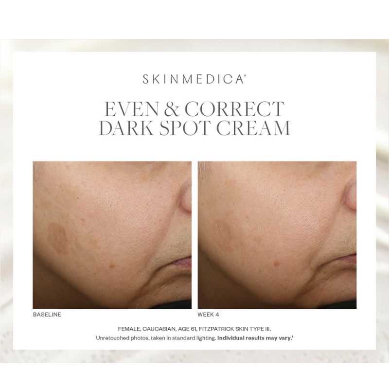 SkinMedica sold Even & Correct Dark Spot Cream