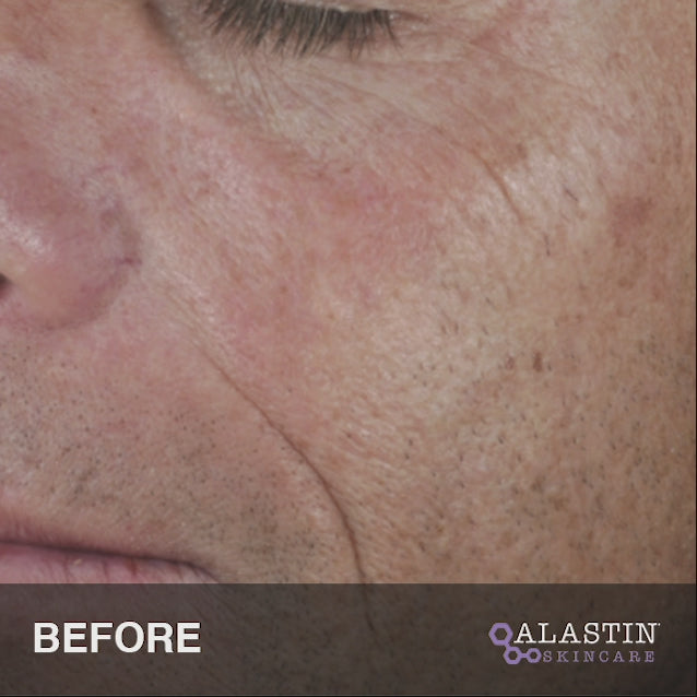 Load video: Alastin Restorative Skin Complex