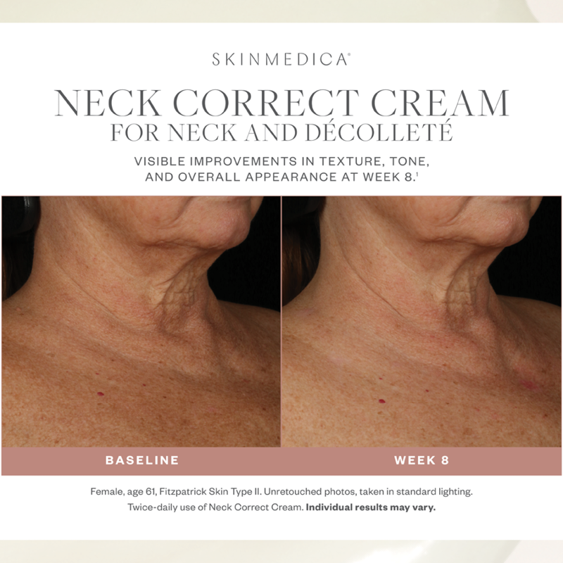 SkinMedica Neck Correct